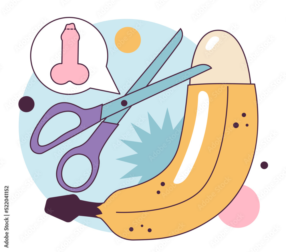 Male Circumcision Surgical Removal Procedure Of The Foreskin Stock 
