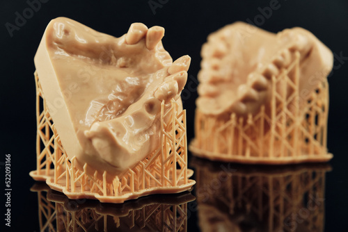 3D Printing Dental Crowns and Bridge Models. Orthodontic model for dental
