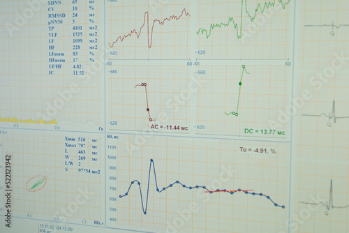 Bicycle Ergometry Electrocardiography, bicycle ergometer stress test. Athlete does a cardiac stress test in a medical study, monitored by the doctor photo