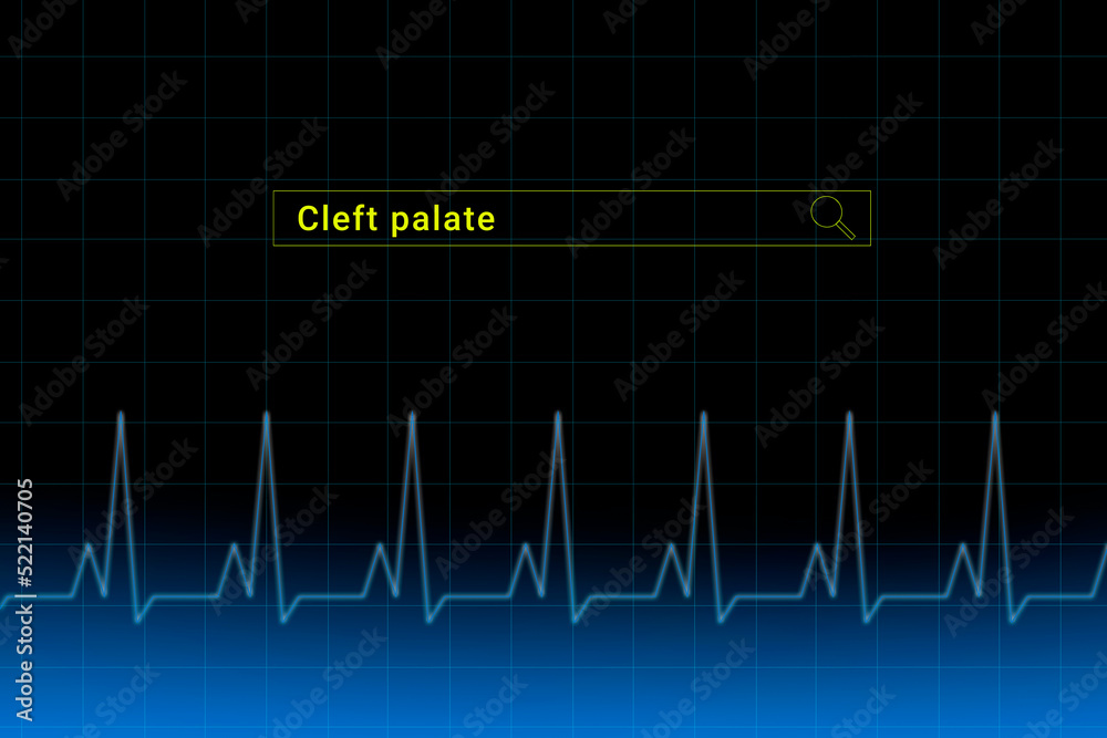 Cleft palate.Cleft palate inscription in search bar. Illustration with titled Cleft palate . Heartbeat line as a symbol of human disease.