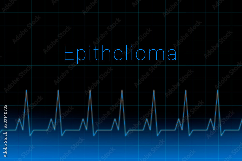 Epithelioma disease. Epithelioma logo on a dark background. Heartbeat line as a symbol of human disease. Concept Medication for disease Epithelioma. Epithelioma disease. Epithelioma logo on a dark background. Heartbeat line as a symbol of human disease. Concept Medication for disease Epithelioma.