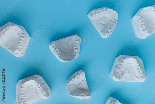 Top view of dental plaster casts of human teeth
