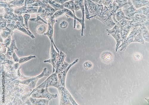 Obraz na plátně Human embryonic kidney (HEK293) cells cultured in vitro