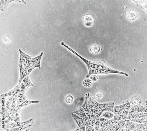 Human embryonic kidney (HEK293) cells cultured in vitro. Microscopic phase contrast image. Such cells are used in biomedical research, drug discovery, cell signalling and genetics. 