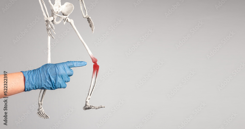 Fototapeta premium Banner with doctor forefinger pointing to skeleton knee with red spot. Leg pain, bones injury, overuse. Skeletal system anatomy, body structure, medical education. Copy space. High quality photo