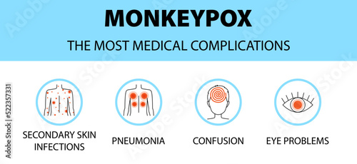 Monkeypox virus icons infographic. The most medical complications. New outbreak cases in Europe and USA.