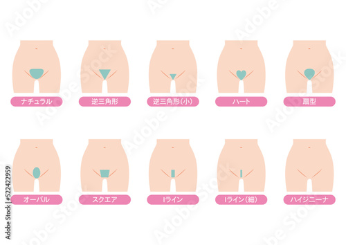 Vライン脱毛のデザイン
