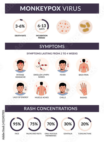 Monkeypox virus symptoms vector infographic. Rash concentration, rate, fever, headache, backpain. Flat design with icons