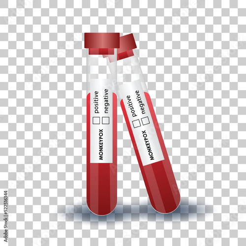 Monkeypox virus, monkeypox cells, vector