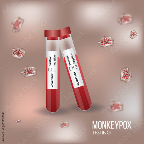 Monkeypox virus, monkeypox cells, vector