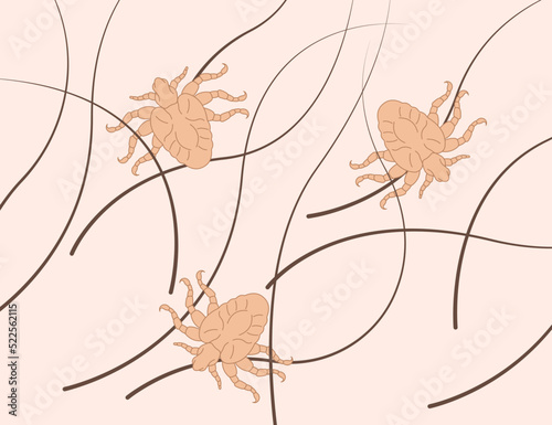 Pubic lice Tiny Bed Bugs tick egg infection body