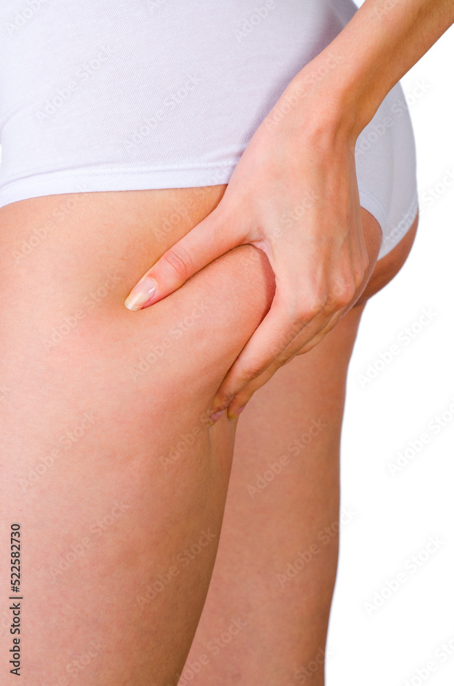 Cellulite skin at woman buttocks
