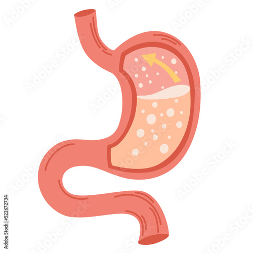 Human stomach. Gastroesophageal reflux disease concept. Unhealthy stomach concept. Heartburn, illness, discomfort, pain. Flat vector illustration isolated on white