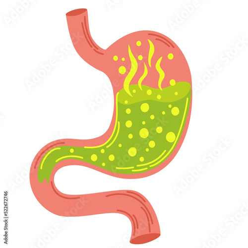 Human stomach. Gastritis and acid reflux, indigestion, vomiting, heartburn and stomach pain problems. Unhealthy stomach concept. Heartburn, illness, discomfort, pain. Flat vector illustration