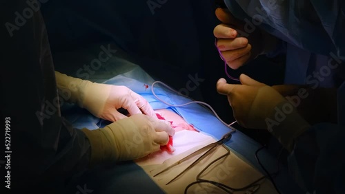 The doctor makes an incision with a scalpel on the abdomen. Plastic surgery operation.  photo