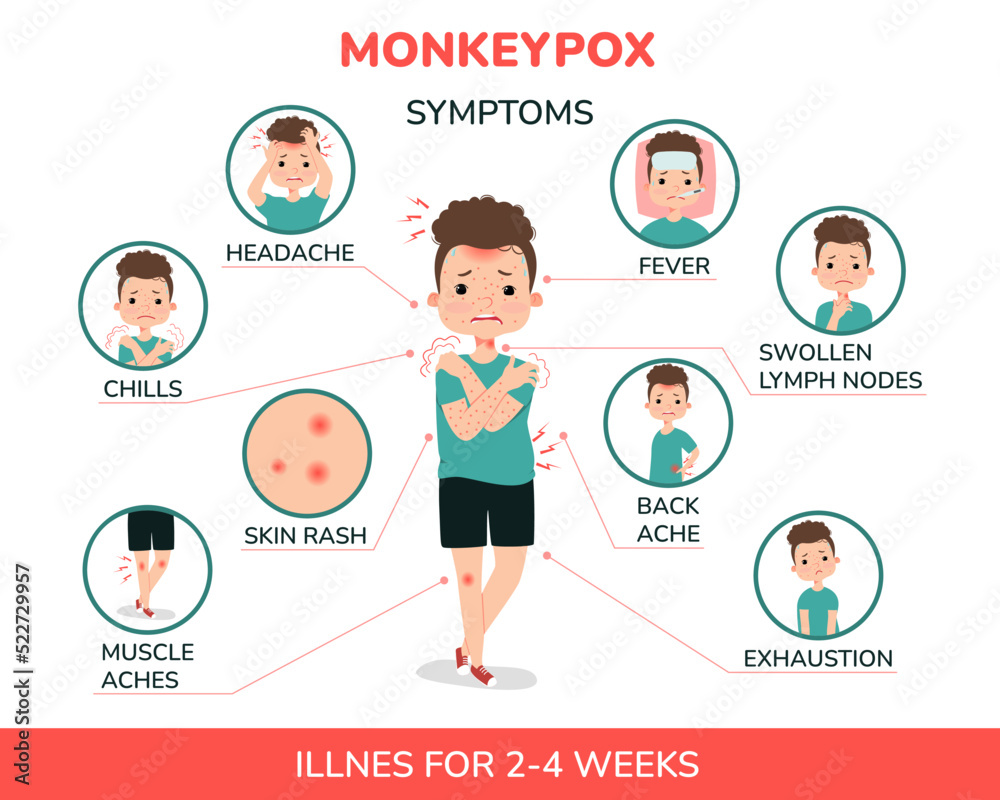 A boy with monkeypox and the symptoms illustration. Fever, headache