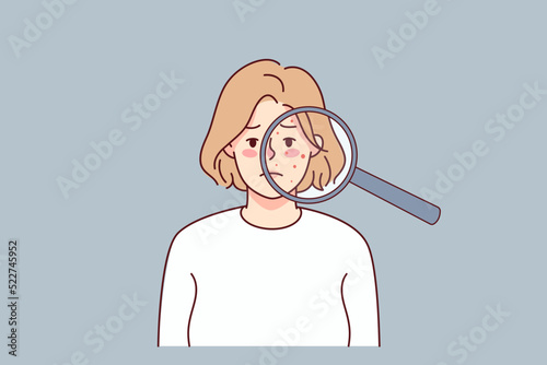 Unhappy woman with acne on face under magnifying glass. Upset young female suffer from skincare problems. Dermatology and cosmetology. Vector illustration. 