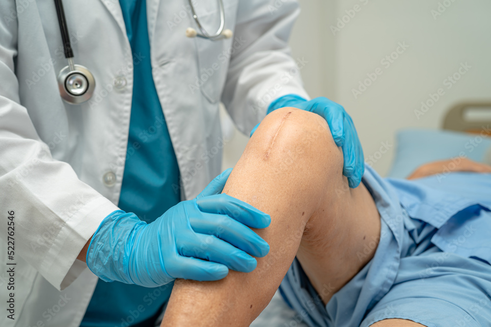 Doctor check Asian senior or elderly old lady woman patient scars surgical total knee joint replacement Suture wound surgery arthroplasty on bed in nursing hospital. Doctor check Asian senior or elderly old lady woman patient scars surgical total knee joint replacement Suture wound surgery arthroplasty on bed in nursing hospital.