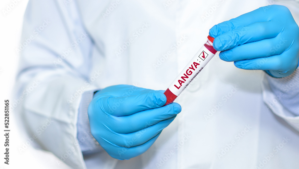 Doctor holding a test blood sample tube with positive Langya henipavirus (LayV).The virus is transmitted from animals to humans. Infected people suffer from fever, cough, headache, nausea and vomiting Doctor holding a test blood sample tube with positive Langya henipavirus (LayV).The virus is transmitted from animals to humans. Infected people suffer from fever, cough, headache, nausea and vomiting
