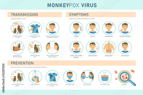 Monkeypox virus transmission, symptoms and prevention infographics with icons. Vector flat illustration for medical concept. Design for banner, poster, flyer.