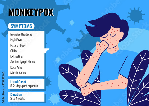 Monkeypox Virus Symptoms Infographic. Monkeypox Virus Preventive Infographic. Monkeypox Infographic Flat Illustration Vector Isolated.