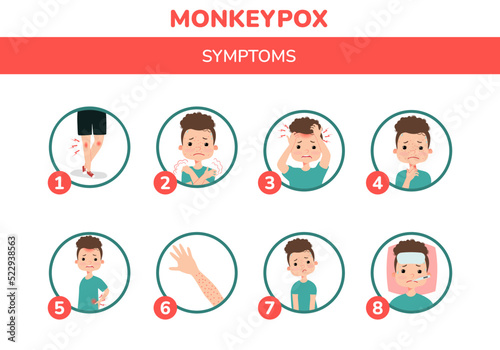 A boy with monkeypox and the symptoms illustration. Fever, headache, swollen lymph node, rashes on face, body and back, muscle aches. For awareness in spreading of orthopoxvirus outbreak.
 photo