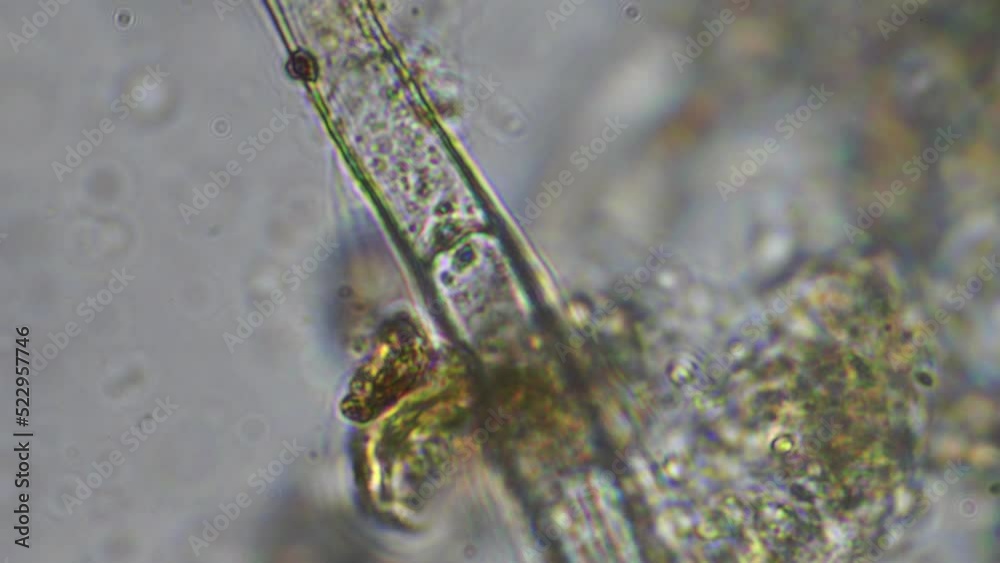 Soil fungi and fungus in a biology soil test in Australia. Bacteria and ...