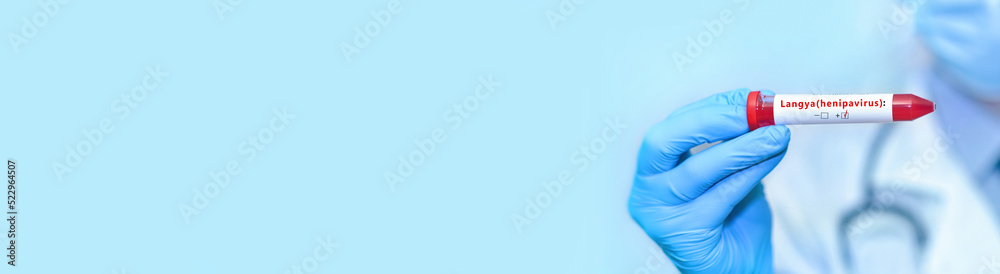 Doctor holding a test blood sample tube with positive Langya henipavirus (LayV).The virus is transmitted from animals to humans.Banner. Copy space for text. Doctor holding a test blood sample tube with positive Langya henipavirus (LayV).The virus is transmitted from animals to humans.Banner. Copy space for text.