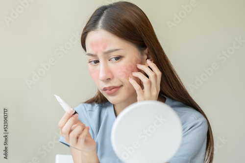 Dermatology, asian young woman looking at mirror, holding cream tube in hand, expression worry and itch, itchy allergy or allergic sensitive reaction, red or rash on face. Beauty care of skin problem