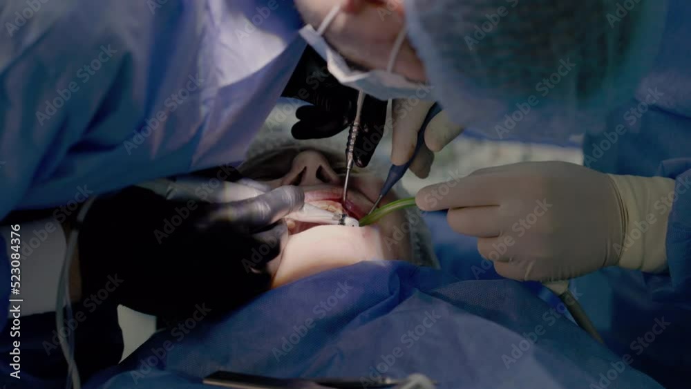 Dentists install artificial teeth to an old woman during surgery. Medical operation to provide emergency care to an old person Dentists install artificial teeth to an old woman during surgery. Medical operation to provide emergency care to an old person