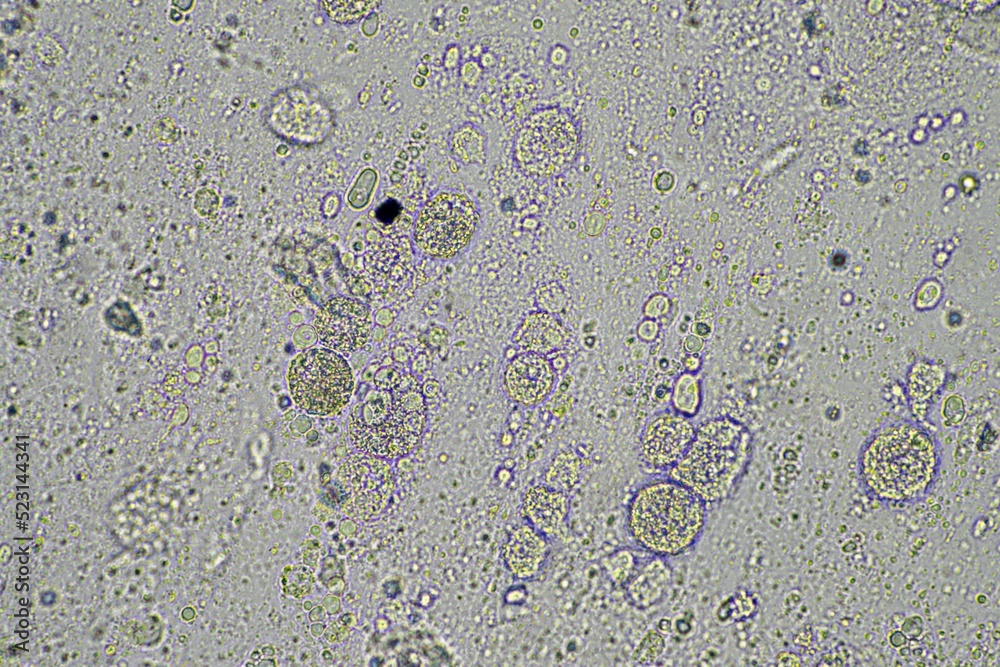 coughing, Phlegm and mucus under the microscope Stock Photo | Adobe Stock