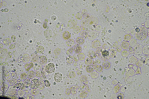 coughing, Phlegm and mucus under the microscope