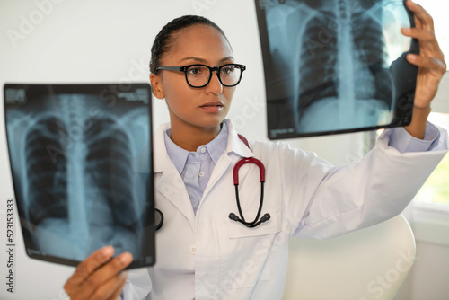 Portrait of confident pulmonologist examining x-ray of human chest. Young African American general practitioner looking at x-ray pictures of patients. Radiology research, pneumonia or asthma concept photo