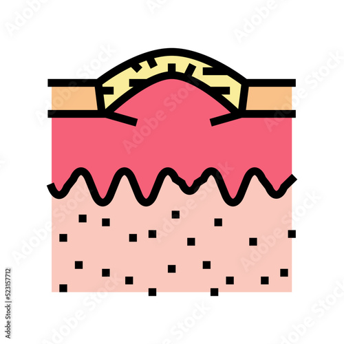 boxcar acne scar color icon vector. boxcar acne scar sign. isolated symbol illustration