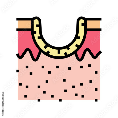 rolling acne scar color icon vector. rolling acne scar sign. isolated symbol illustration