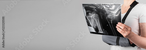 Photos Hands with trauma, fracture holding X ray scan in hand