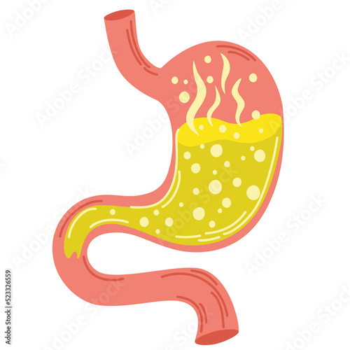 Human stomach. Gastritis and acid reflux, indigestion, vomiting, heartburn and stomach pain problems. Unhealthy stomach concept. Heartburn, illness, discomfort, pain. Flat vector illustration