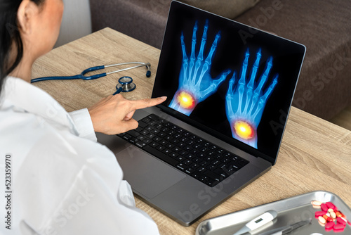 Close up of doctor showing x-ray of hands 
