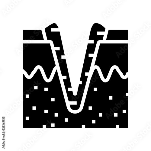 ice pick acne scar glyph icon vector. ice pick acne scar sign. isolated symbol illustration