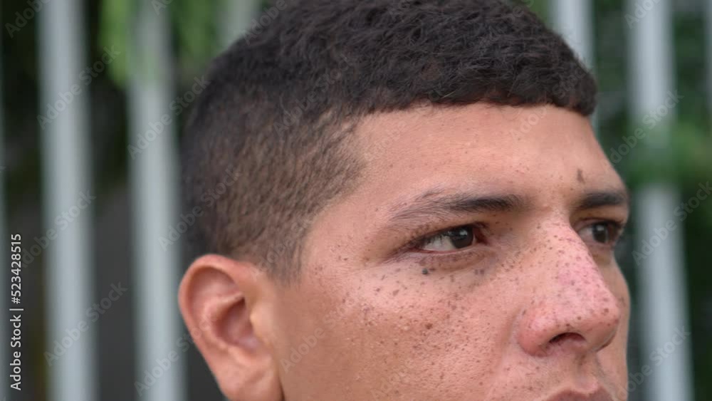 man with freckles opening his eyes and looking at the camera. man with freckles opening his eyes and looking at the camera.