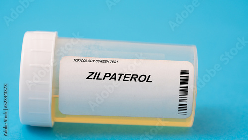 Zilpaterol. Zilpaterol toxicology screen urine tests for doping and drugs