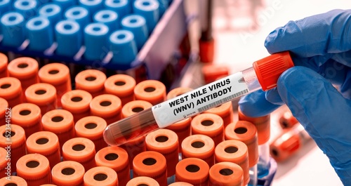 Fotografía West Nile Virus (WNV) Antibody Test tube with blood sample in infection lab