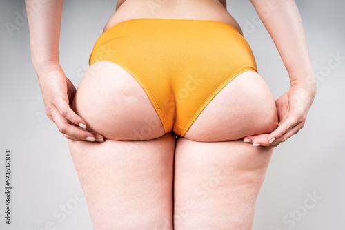 Overweight thigh, woman with fat hips and buttocks, obesity female body with cellulite on gray background