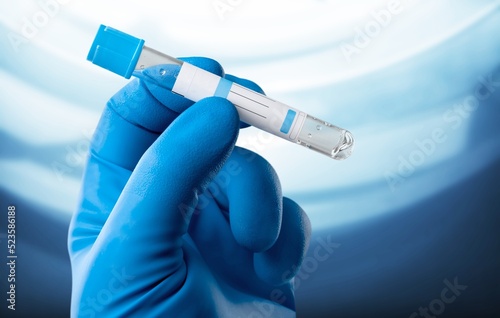 doctor holding Blood tube for Virus analysis and identification.