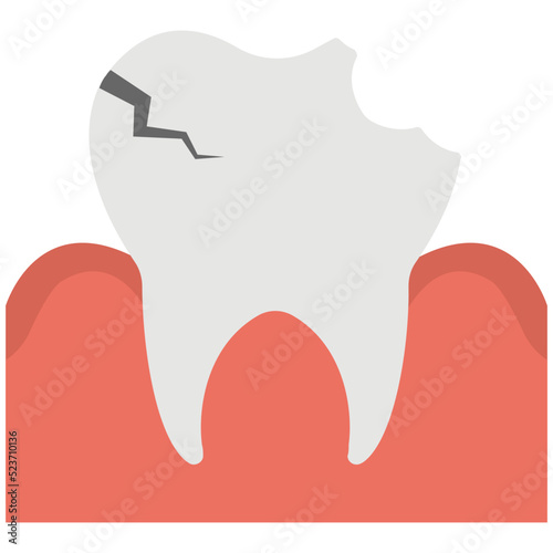 Dental Caries