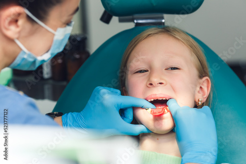 the dentist makes a jaw shape to take an impression of the patient's teeth.