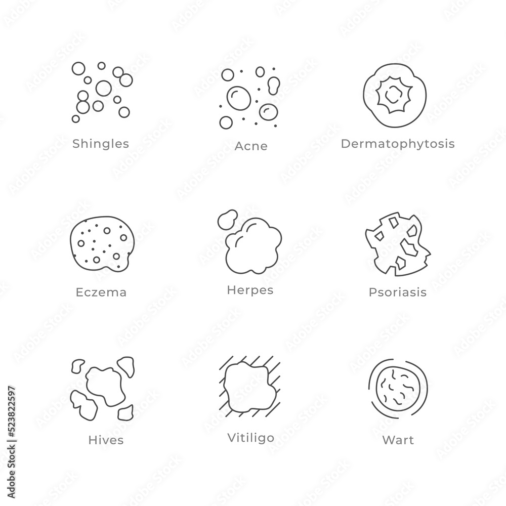 Set line icons of skin disease