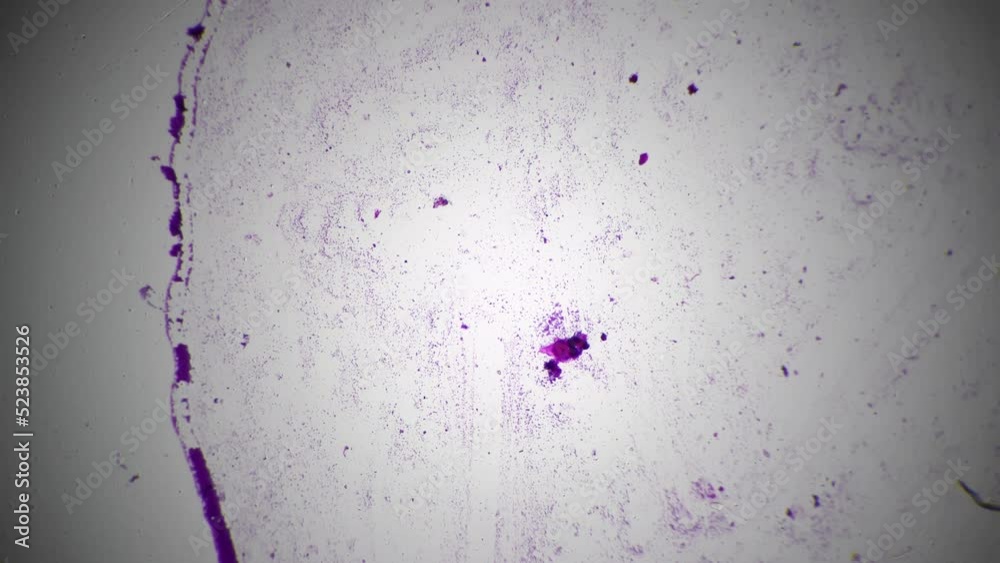 Three types of bacteria are filmed under microscope against bright