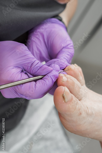 medical pedicure specialist s hands and client s feet