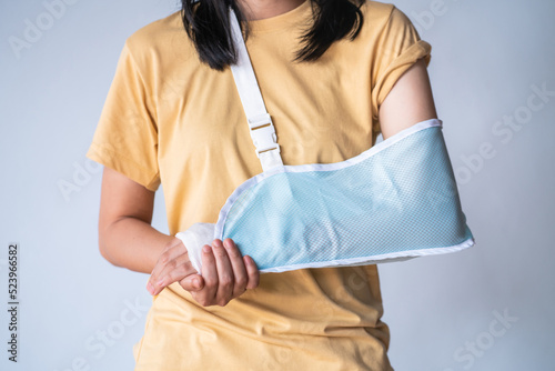 woman is a broken arm and put on arm sling.